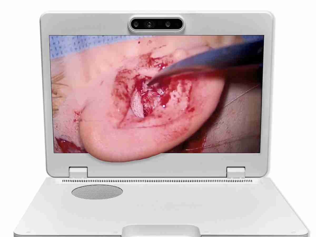 达擎之＂Heads-up 3D显微手术显示系统＂，，，整合4K裸眼3D显示及眼球追踪系统，，，具备快速追踪人眼移动位置功能，，，减轻医师长时间维持固定姿势的负担，，让医师能有更宽广清晰的3D立体视野及更舒适的姿势来执行手术。。